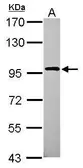 Anti-XAB2 antibody [N1N2], N-term used in Western Blot (WB). GTX100090