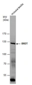 Anti-BRDT antibody [C3], C-term used in Western Blot (WB). GTX100201