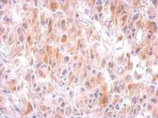 Anti-GSTM1 antibody used in IHC (Paraffin sections) (IHC-P). GTX100298