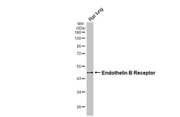 Anti-Endothelin B Receptor antibody used in Western Blot (WB). GTX100357