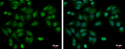 Anti-UBE2A antibody used in Immunocytochemistry/ Immunofluorescence (ICC/IF). GTX100426