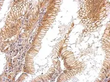 Anti-EGFR antibody [C2C3], C-term used in IHC (Paraffin sections) (IHC-P). GTX100448
