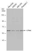 Anti-c-Yes antibody used in Western Blot (WB). GTX100616