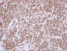 Anti-Topoisomerase II alpha antibody [C3], C-term used in IHC (Paraffin sections) (IHC-P). GTX100689