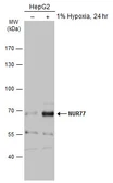 Anti-NUR77 antibody used in Western Blot (WB). GTX100797