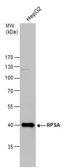 Anti-RPSA antibody [N1C3] used in Western Blot (WB). GTX100831