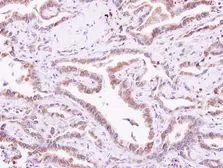 Anti-CIB1 antibody used in IHC (Paraffin sections) (IHC-P). GTX100849