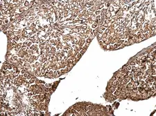 Anti-B-Raf antibody [N2C1], Internal used in IHC (Paraffin sections) (IHC-P). GTX100913