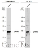 Anti-ZAP70 antibody used in Western Blot (WB). GTX101076