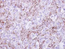 Anti-G6PD antibody used in IHC (Paraffin sections) (IHC-P). GTX101212