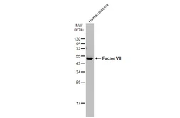 Anti-Factor VII antibody [N3C3] used in Western Blot (WB). GTX101238