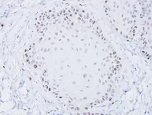Anti-BLM antibody [C3], C-term used in IHC (Paraffin sections) (IHC-P). GTX101303
