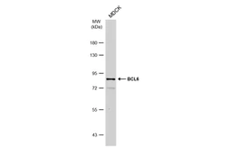 Anti-BCL6 antibody [N2C1], Internal used in Western Blot (WB). GTX101338