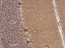 Anti-Aldolase A antibody used in IHC (Paraffin sections) (IHC-P). GTX101408