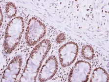 Anti-PABPN1 antibody used in IHC (Paraffin sections) (IHC-P). GTX101490