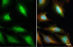 Anti-CHD4 antibody used in Immunocytochemistry/ Immunofluorescence (ICC/IF). GTX101662