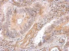 Anti-DAP5 antibody [C2C3], C-term used in IHC (Paraffin sections) (IHC-P). GTX101712