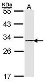 Anti-Proteasome beta 4 antibody [N1C3] used in Western Blot (WB). GTX101780