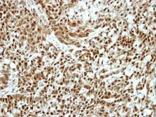 Anti-Ku70 antibody [N1N3] used in IHC (Paraffin sections) (IHC-P). GTX101848