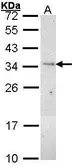Anti-PLSCR3 antibody [N1C3] used in Western Blot (WB). GTX101987