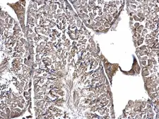 Anti-EIF3K antibody used in IHC (Paraffin sections) (IHC-P). GTX101995