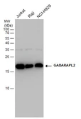 Anti-GABARAPL2 antibody used in Western Blot (WB). GTX102006