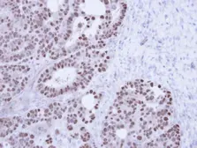 Anti-TAP antibody [N1N2], N-term used in IHC (Paraffin sections) (IHC-P). GTX102071
