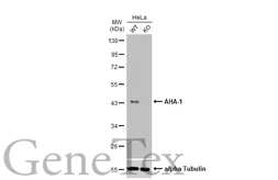 Anti-AHA-1 antibody [N2C3] used in Western Blot (WB). GTX102321