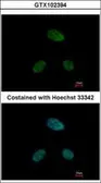 Anti-DRAK1 antibody [N1C1] used in Immunocytochemistry/ Immunofluorescence (ICC/IF). GTX102394