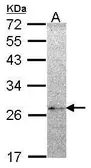 Anti-NME5 antibody [N1C3] used in Western Blot (WB). GTX102475
