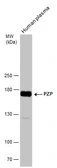 Anti-PZP antibody used in Western Blot (WB). GTX102547