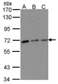 Anti-TROVE2 antibody [N2C3] used in Western Blot (WB). GTX102663