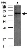 Anti-TMLHE antibody [N2C3] used in Western Blot (WB). GTX102856