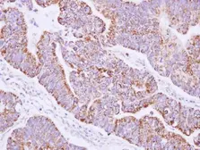 Anti-JIK antibody [N2C2], Internal used in IHC (Paraffin sections) (IHC-P). GTX102894
