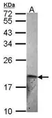 Anti-ET-2 antibody [N1C3] used in Western Blot (WB). GTX102946