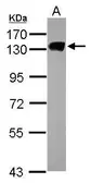 Anti-MCM2 antibody [N1N2], N-term used in Western Blot (WB). GTX103071