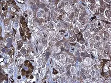Anti-MMP10 antibody used in IHC (Paraffin sections) (IHC-P). GTX103287