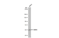 Anti-DARS antibody [N1C1] used in Western Blot (WB). GTX103374