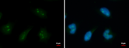 Anti-DDX18 antibody used in Immunocytochemistry/ Immunofluorescence (ICC/IF). GTX103392