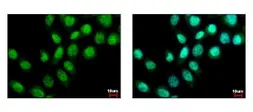 Anti-BS69 antibody used in Immunocytochemistry/ Immunofluorescence (ICC/IF). GTX103403
