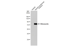 Anti-Vitronectin antibody used in Western Blot (WB). GTX103475