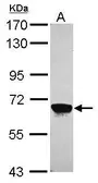 Anti-MPP2 antibody [N1C3] used in Western Blot (WB). GTX103908