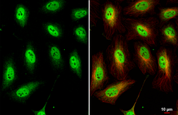 Anti-TEAD4 antibody used in Immunocytochemistry/ Immunofluorescence (ICC/IF). GTX104026