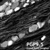Anti-PGP9.5 antibody used in IHC (Frozen sections) (IHC-Fr). GTX10404
