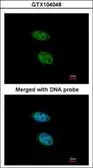 Anti-PRPS2 antibody [N1C3] used in Immunocytochemistry/ Immunofluorescence (ICC/IF). GTX104048