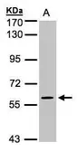 Anti-MAPK4 antibody [N1C1] used in Western Blot (WB). GTX104128