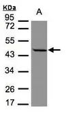 Anti-STOML1 antibody [N2C3] used in Western Blot (WB). GTX104187