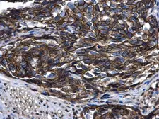 Anti-ARFIP2 antibody [N1C2] used in IHC (Paraffin sections) (IHC-P). GTX104241