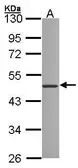 Anti-ZNF277 antibody [N2C3] used in Western Blot (WB). GTX104272