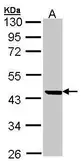 Anti-M/NEI antibody [N1C2] used in Western Blot (WB). GTX104522